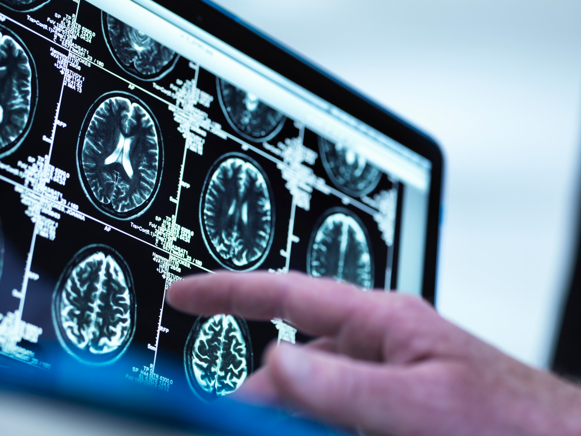 What does it take to unleash the power of data in optical networks?