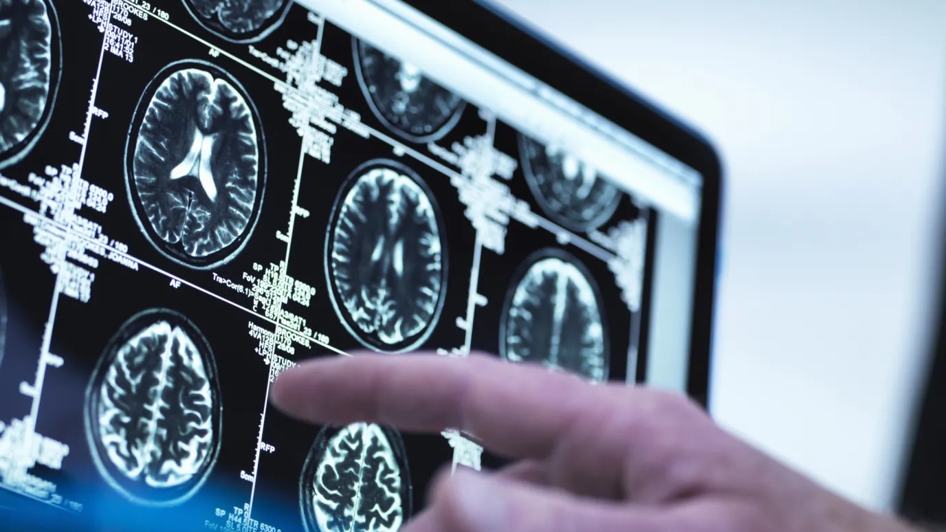 What does it take to unleash the power of data in optical networks?