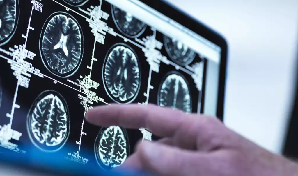 hand pointing at display of brain scans