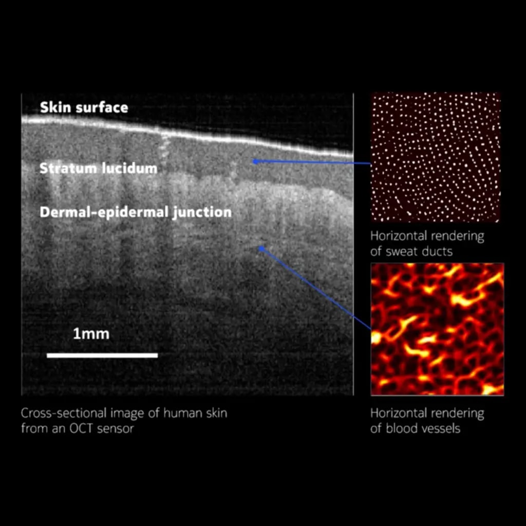 Cross-sectional image of human skin from an OCT sensor