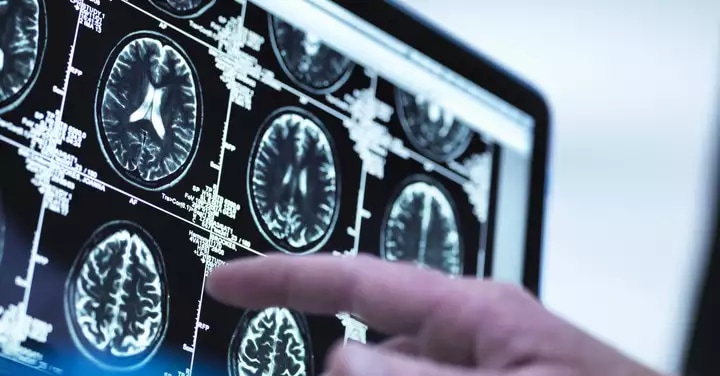 What does it take to unleash the power of data in optical networks?