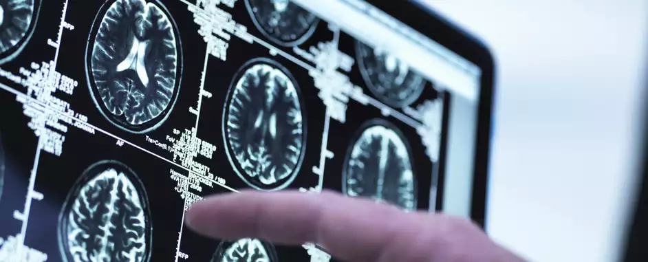 What does it take to unleash the power of data in optical networks?