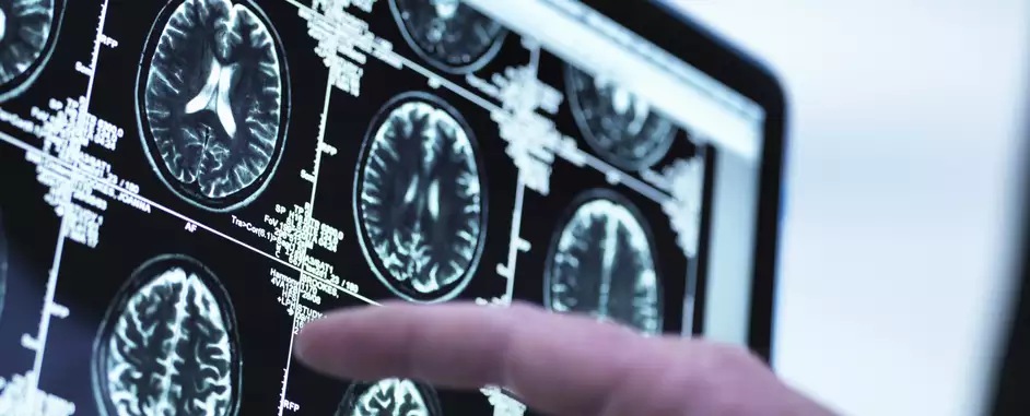 What does it take to unleash the power of data in optical networks?
